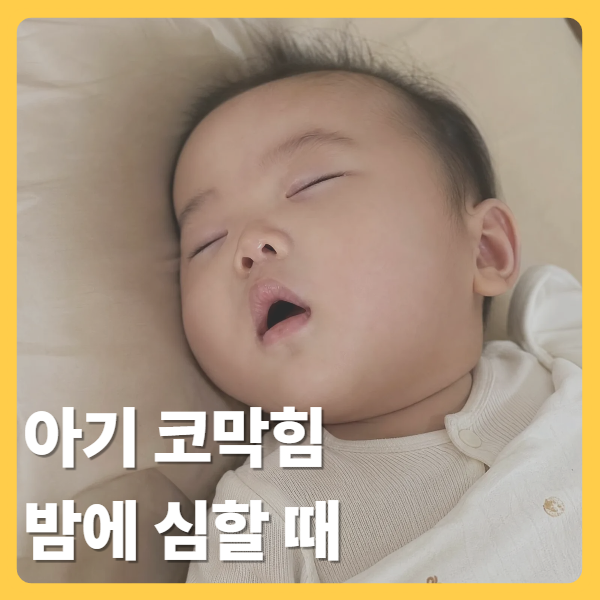 아기 코막힘 밤에 심할 때? 잠 못 잘 때 약, 해결 방법 (6개월 이전 아기)