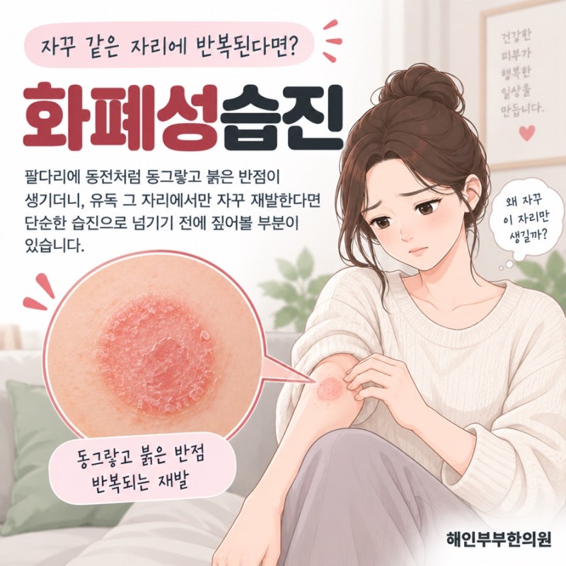 일반 습진과 헷갈리는 수원 화폐상습진 구별 포인트
