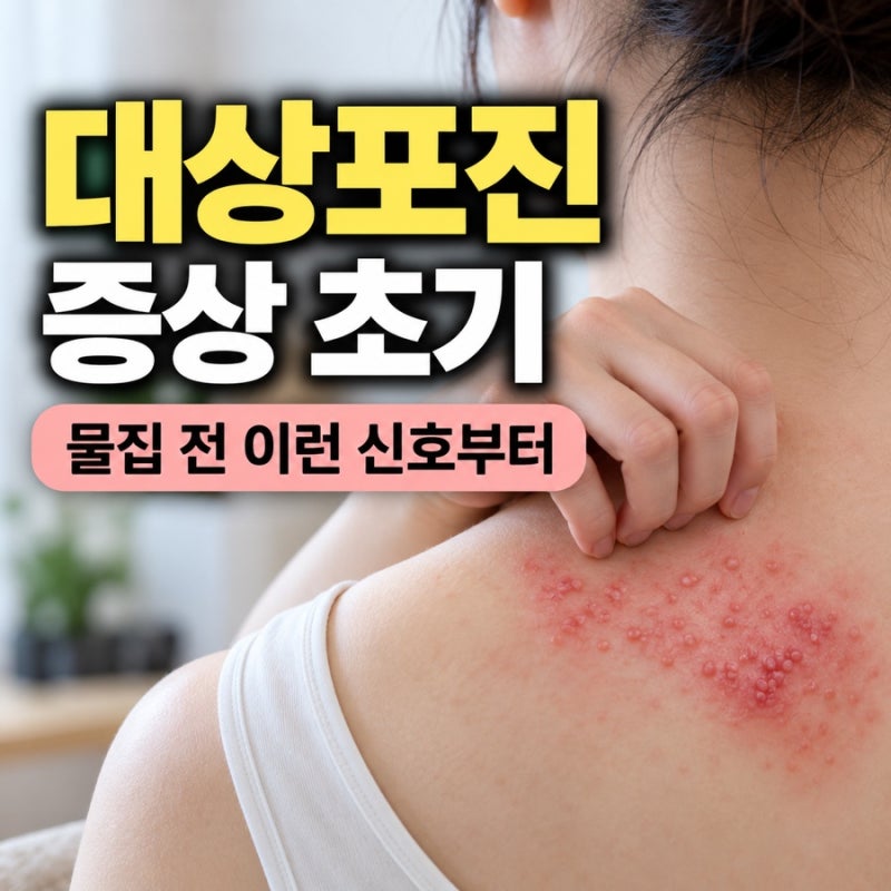 대상포진 증상 초기 어떻게 시작될까? 얼굴·팔·다리·허벅지 부위별 신호