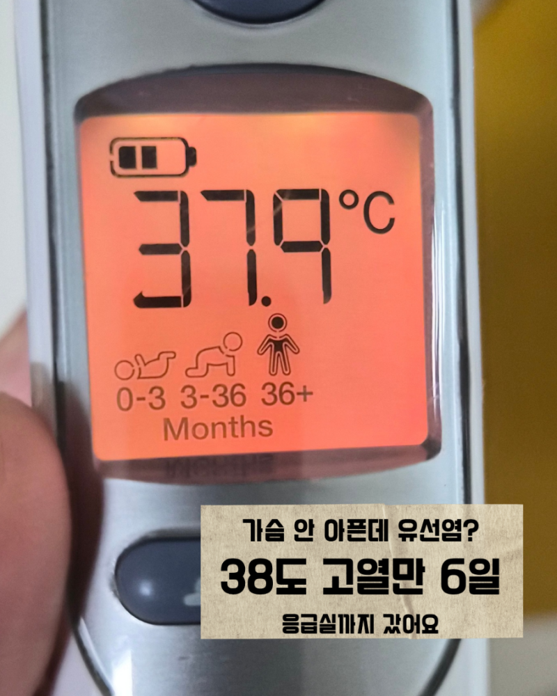 가슴 안 아픈 유선염도 있어요｜38도 고열 6일, 응급실 검사 정상인데 원인은 유선염