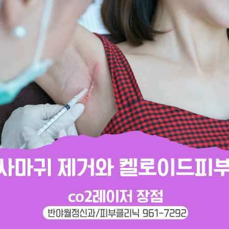 대구 동구 반야월 피부 편평사마귀 제거 시 켈로이드 피부의 주의 사항