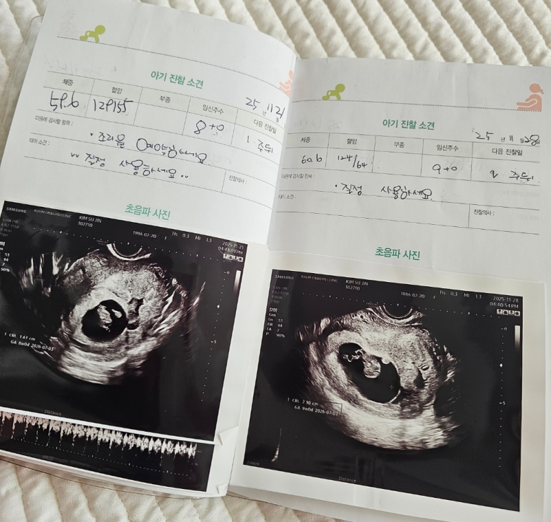 임신 초기 피고임, 6주부터 11주까지 마음 졸였던 시간 단축근무로 해결!