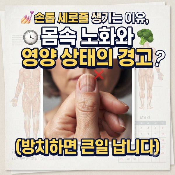 손톱 세로줄 생기는 이유 몸속 노화와 영양 상태의 경고 (방치하면 큰일 납니다)