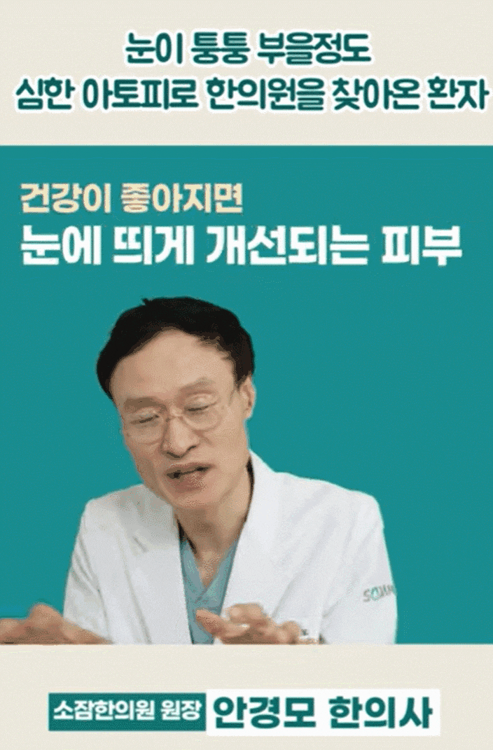 성인얼굴아토피피부염 해결하면 재발 막습니다