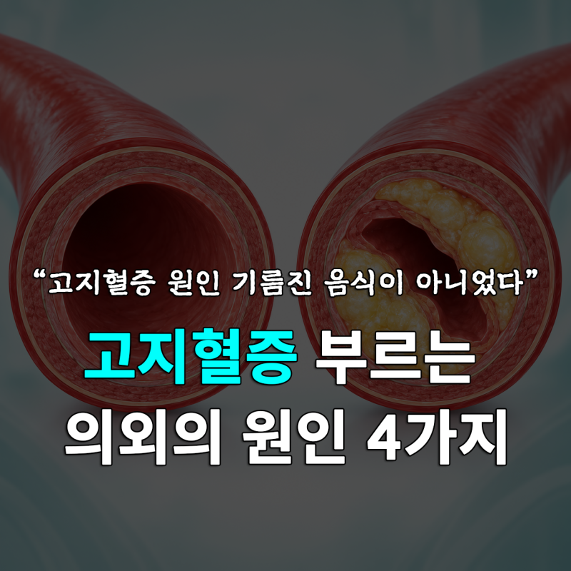 LDL 콜레스테롤이 높아지는 이유, 고지혈증을 부르는 원인 4가지 ｜고지혈증 예방법 ｜증상 ....
