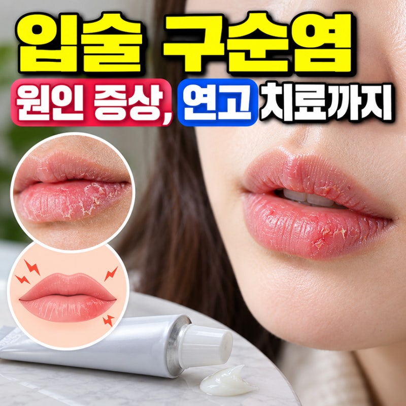 입술 구순염 원인 증상, 연고 치료까지