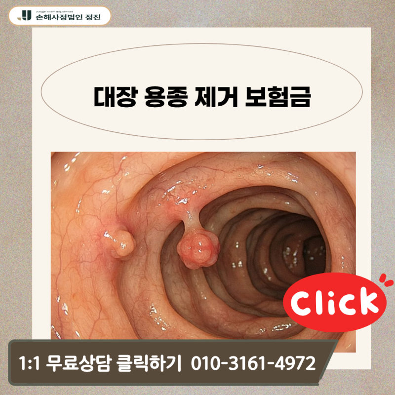 대장 용종 제거 암보험금, D12 코드인데 전액 거절당하셨나요?