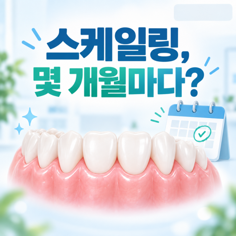 스케일링 주기, 1년에 한 번이면 충분할까요?