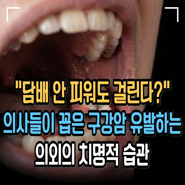 "담배 안 피워도 걸린다?" 의사들이 꼽은 구강암 유발하는 의외의 치명적 습관