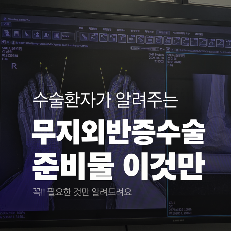 무지외반증수술 준비물ㅣ꼭 필요한것만 알려드릴게요.