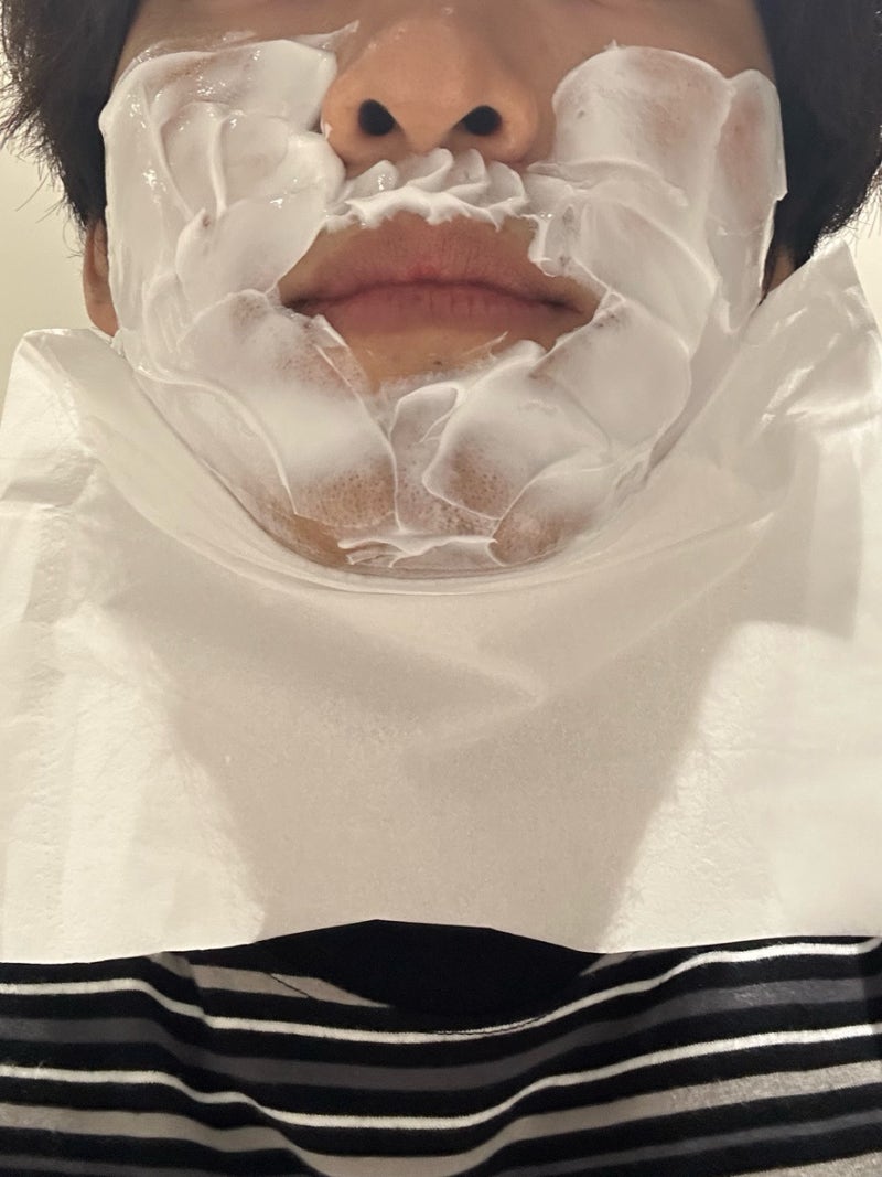 대구 남자 수염 레이저 제모 젠틀맥스프로 3회차 찐 후기!