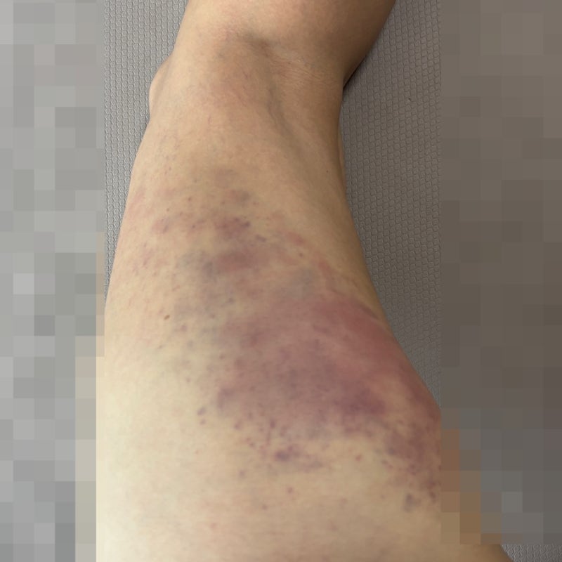 well247 바디튠v2 솔직후기 복부 허벅지 사용방법 고장 흡입고장 청소방법