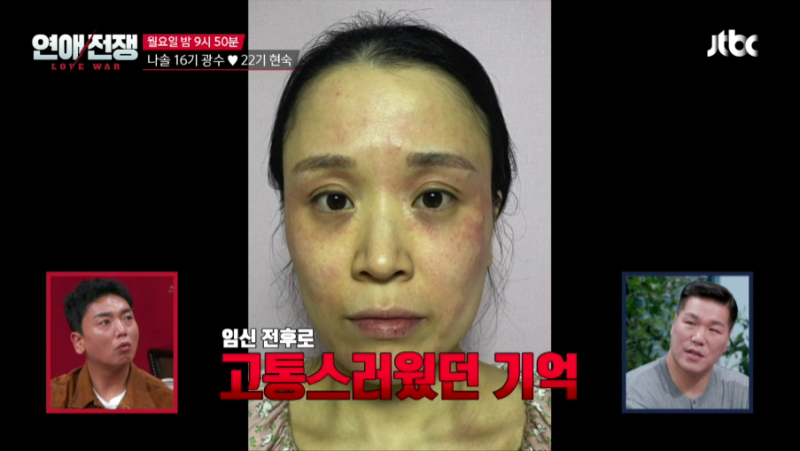22기 현숙이 처음 밝힌 이혼 사유는? 전남편 폭력 고백