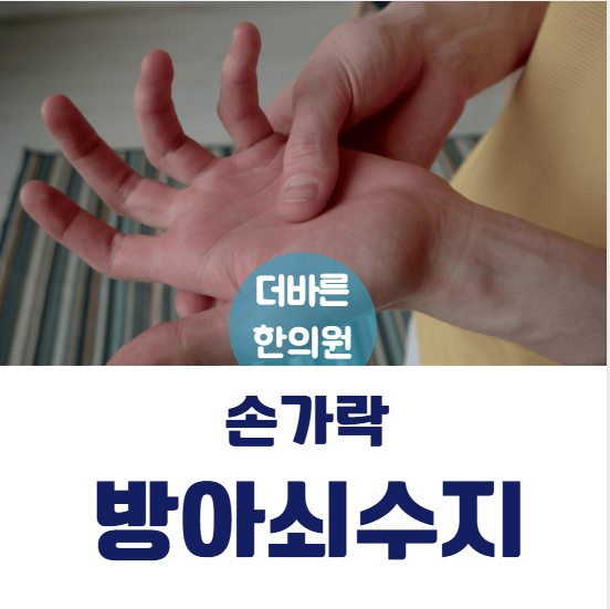 위례 한의원 , 손가락 통증 방아쇠수지증후군 비수술 치료법