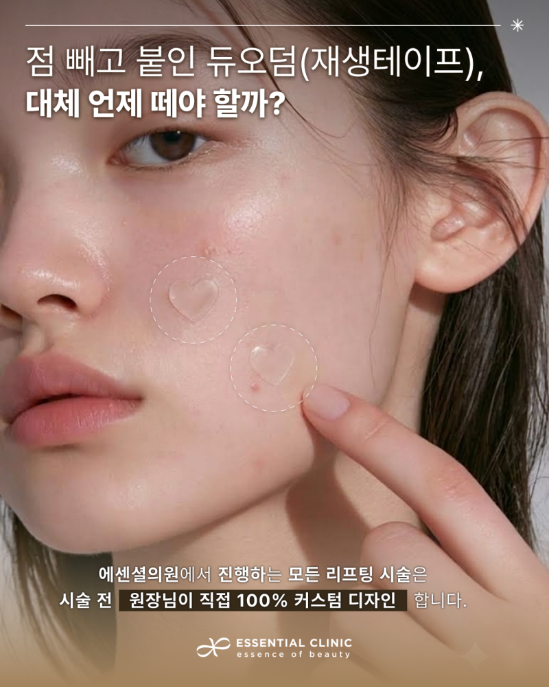 [유주희 원장님_COLUMN] 점제거 후 관리법 : 점빼고 듀오덤 교체 시기, 관리 방법