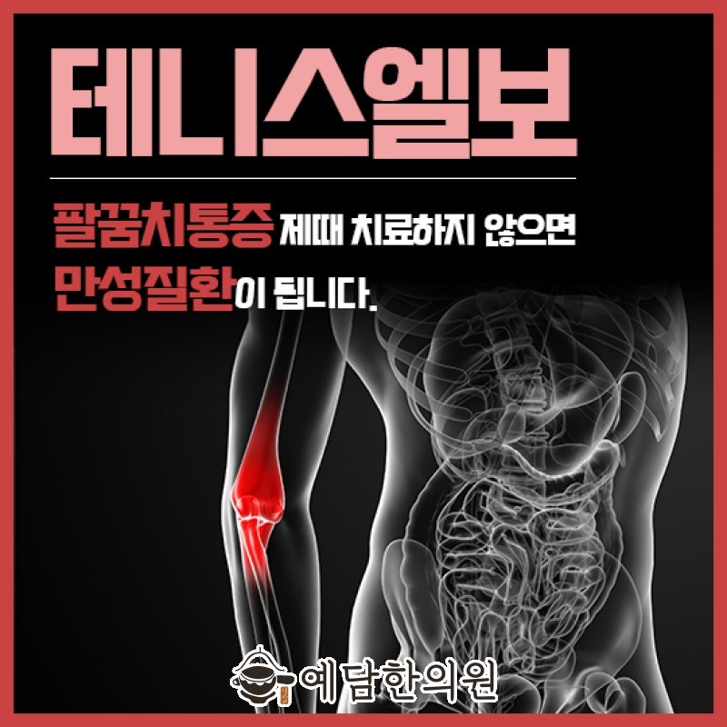 엄궁한의원 테니스엘보(외측상과염) 팔꿈치에 생긴 염증