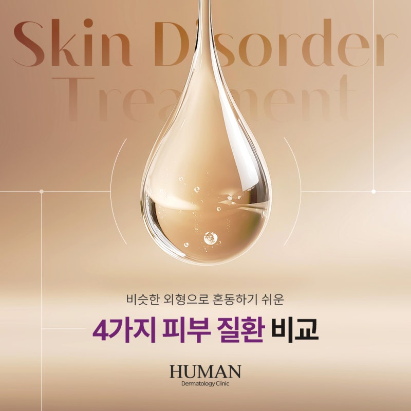 한관종 비립종 쥐젖 편평사마귀 차이 자주 헷갈리는 4가지 피부 질환 비교해 드립니다