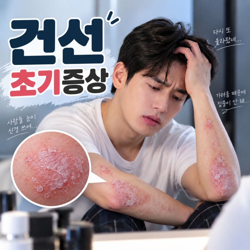 [분당피부과] 건선 초기증상, 단순한 피부 건조증과 어떻게 다를까요?