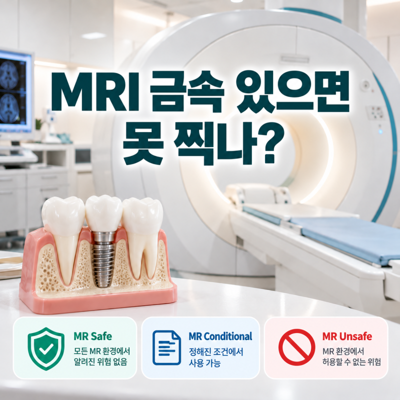 MRI 임플란트 있어도 되나? 촬영 전 확인할 금속 기준