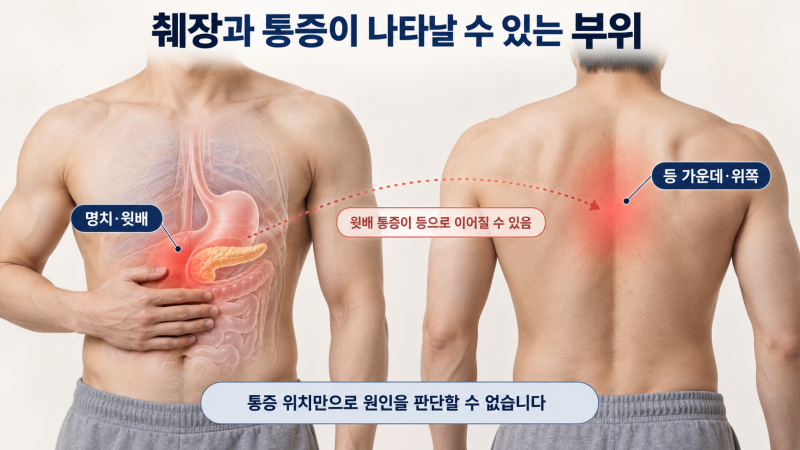 단순 근육통일까? 췌장암 허리통증 위치와 의심해야 할 동반 증상