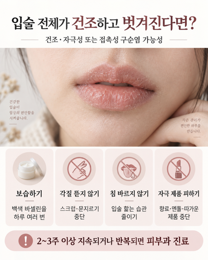 입술구순염 원인, 증상, 치료방법
