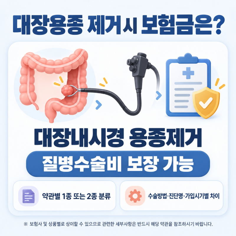 대장 용종 제거 보험, 질병수술비는 어떻게 확인할까?