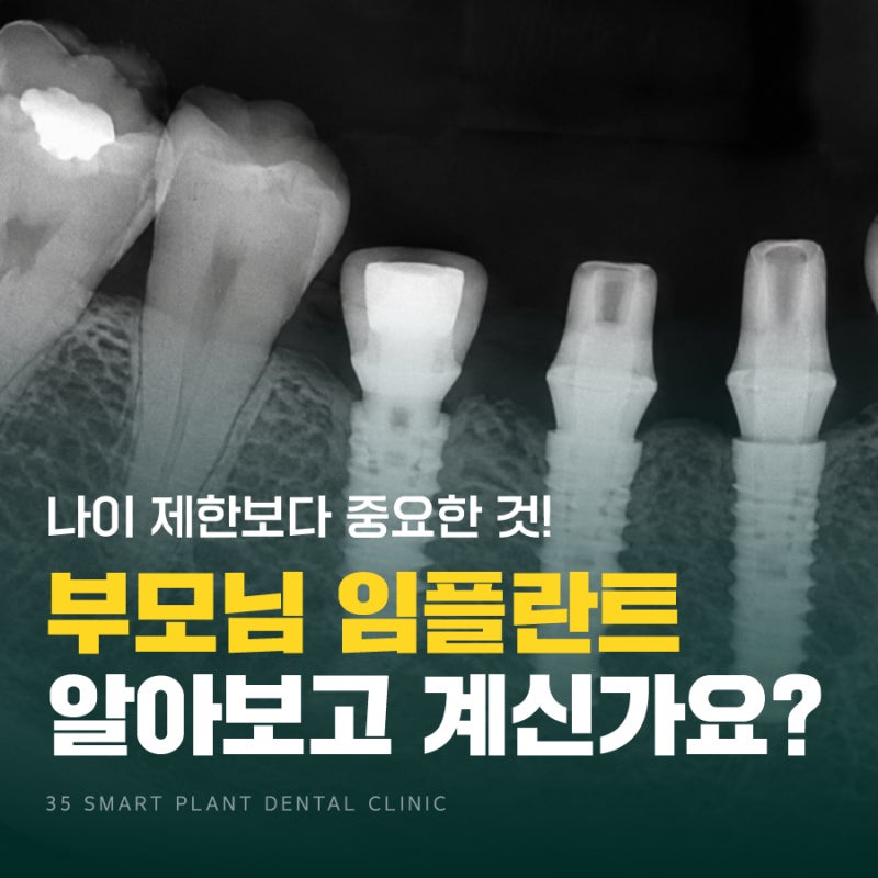 고령의 부모님 임플란트, 나이 제한이 있을까요? 건강보험 기준까지 정리