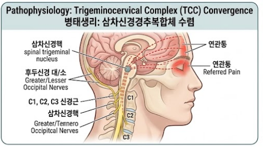 [의학 공부] 원인 모를 진통제 불응성 두통: 경추성 두통(CGH)의 삼차신경-경추 복합체(TCC) 감....