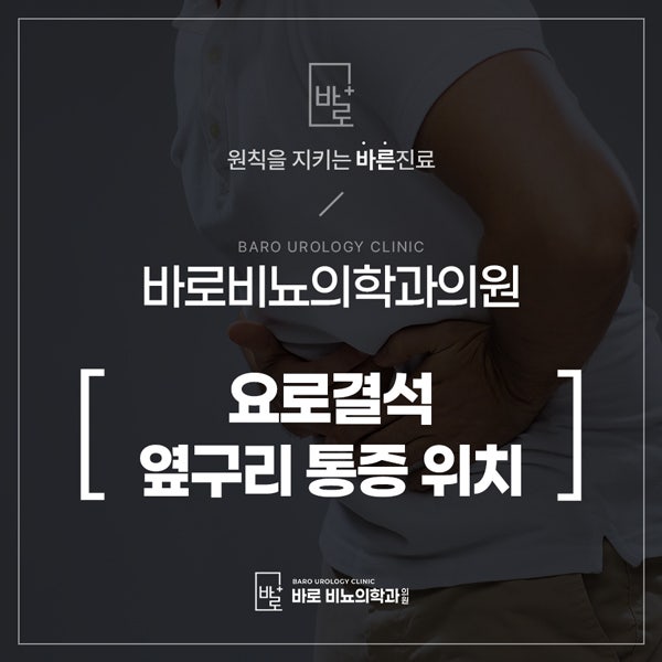 요로결석 옆구리 통증 위치 어디에서 발생할까?