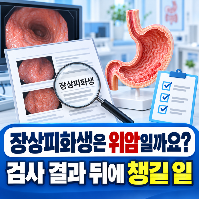 장상피화생은 위암일까요? 검사 결과 뒤에 챙길 일
