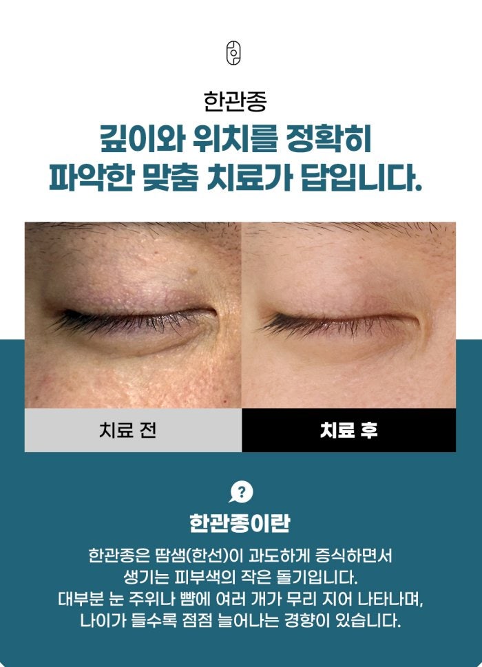 전주한관종, 여러 번 치료받아야 하는 이유