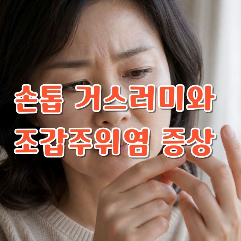 가을 손톱 거스러미가 자꾸 생기는 이유, 뜯다가 생기는 조갑주위염 증상과 대처법
