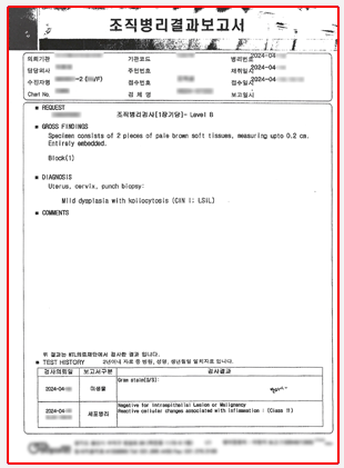 자궁경부이형성증 CIN1 CIN2 CIN3 단계별 회복 관리 재발 방지 방법