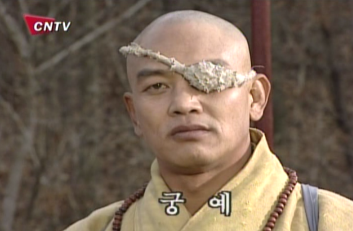 성인 간헐적 사시 수술 후기 (수술 직후~ 3일차)