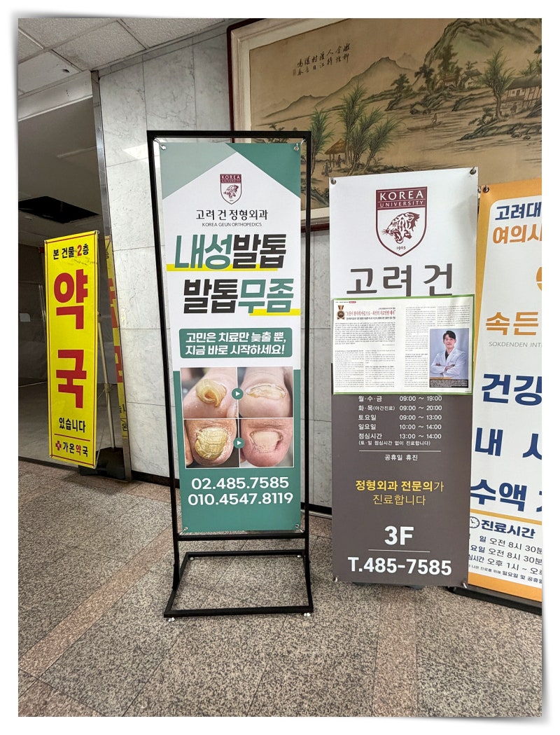 천호동 발톱무좀 관리 병원 추천, 상담부터 치료까지 전문적인 곳
