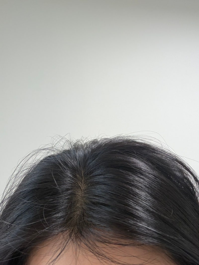 하아르 닥터란 달걀 샴푸로 머리숱 지키기