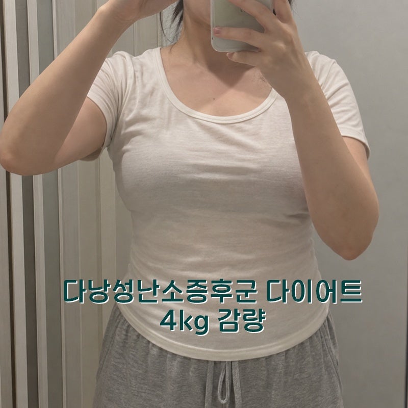 다낭성난소증후군 다이어트 5달 몸무게 기록