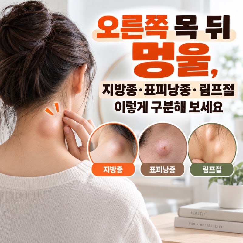 오른쪽 목 뒤 멍울, 지방종·표피낭종·림프절 이렇게 구분해 보세요