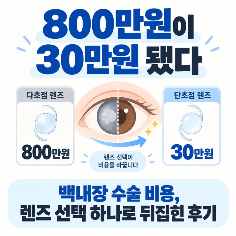 “800만원이 30만원 됐다” 백내장 수술 비용, 렌즈 선택 하나로 뒤집힌 후기