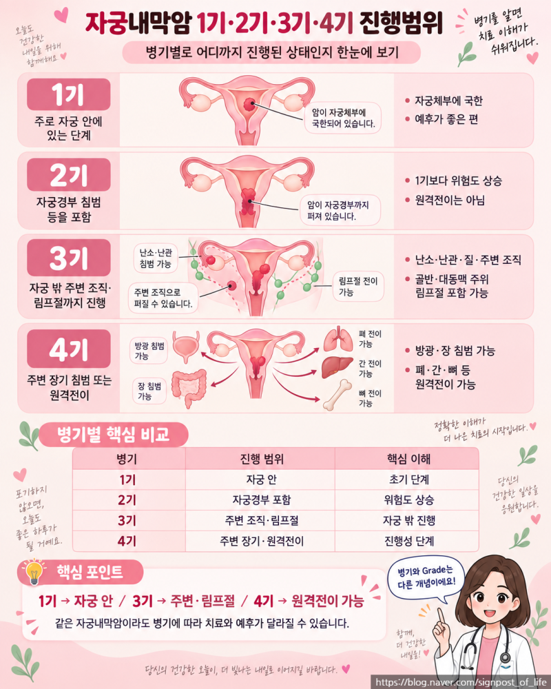 자궁내막암 1기·2기·3기·4기 생존율은 얼마나 될까?