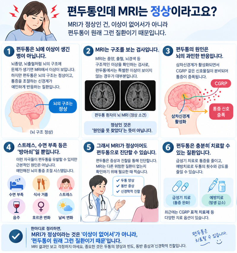 편두통인데 뇌 MRI는 정상이라고요?