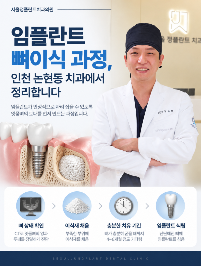 임플란트 뼈이식 과정, 인천 논현동 치과에서 정리합니다
