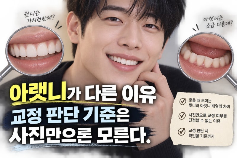 서강준 치열, 아랫니가 고르지 않아 보이는 이유와 교정 판단