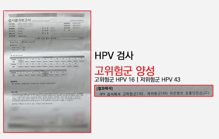 HPV 바이러스 16, 18, 33, 51 치료는 불가능할까? 소멸 치료 방법