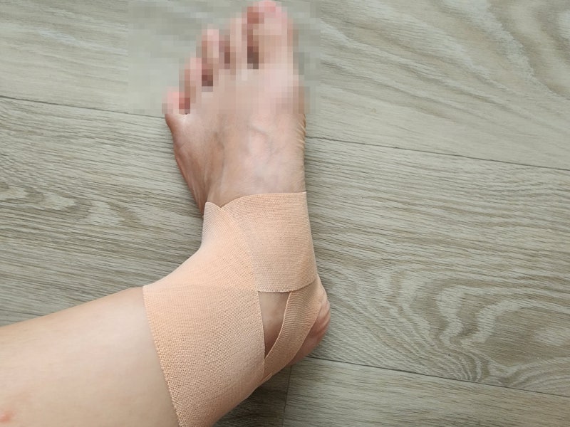 러닝 후 발목 안쪽 통증 있을 때 후경골근 테이핑 방법