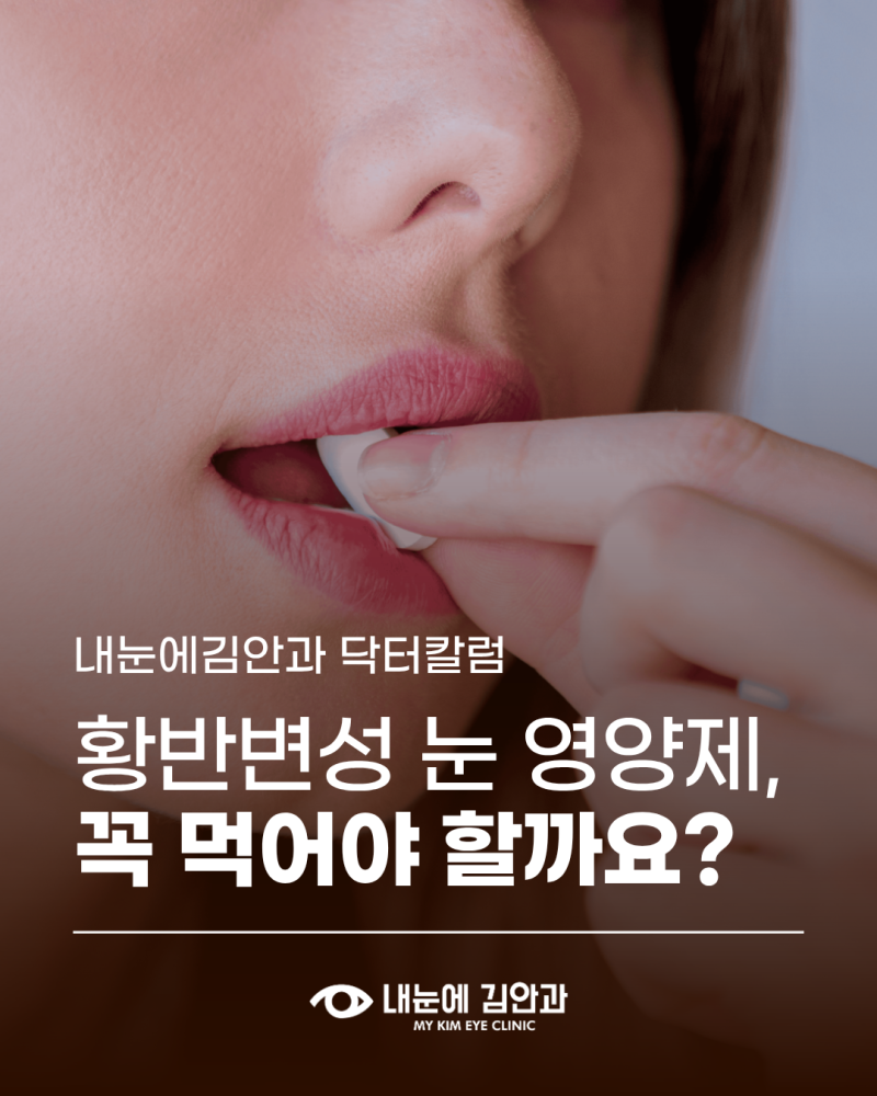 [내눈에김안과 닥터칼럼] 황반변성, 눈 영양제 꼭 먹어야 할까요?