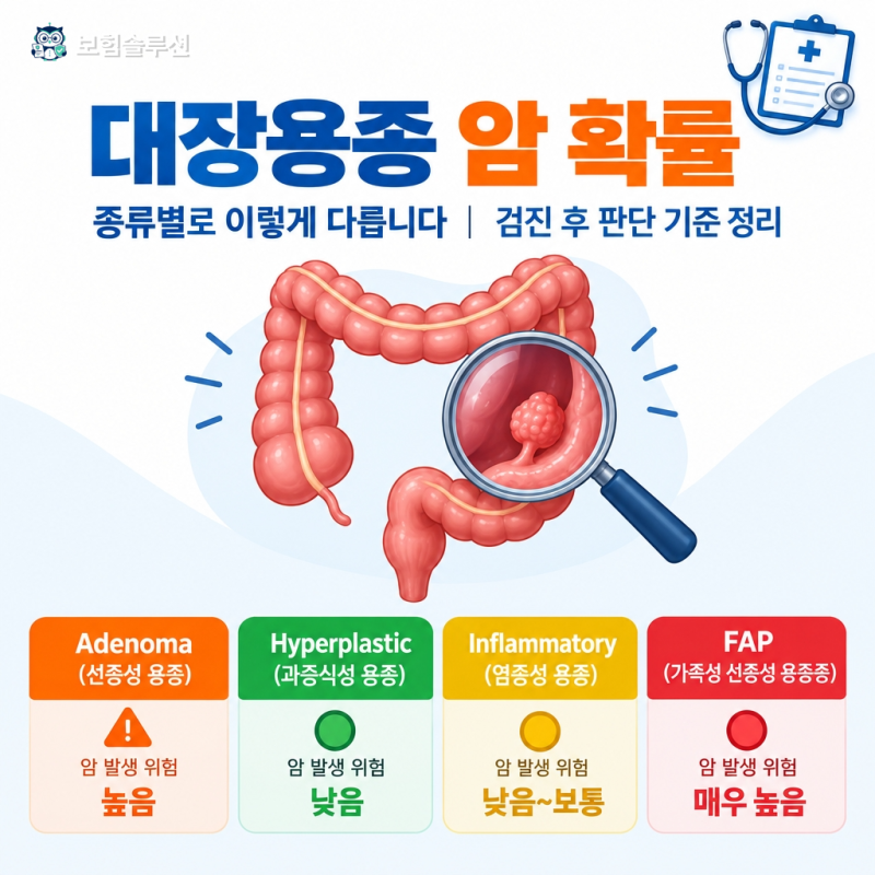 대장용종 암 확률, 종류별로 이렇게 다릅니다｜검진 후 판단 기준 정리