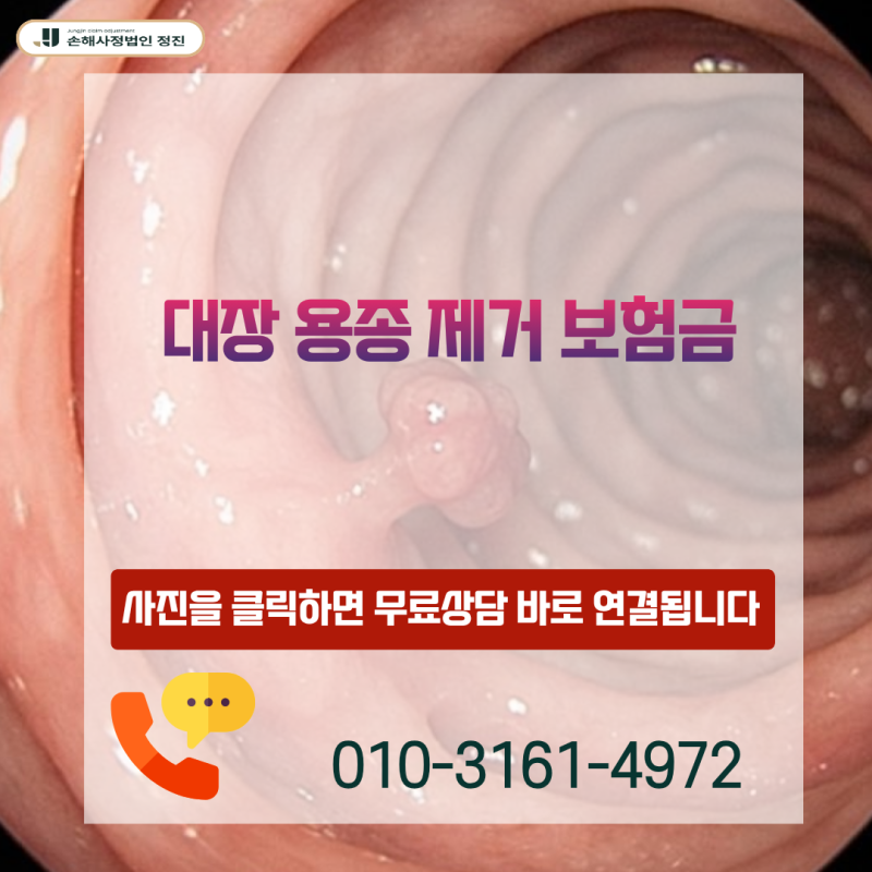 대장 용종 제거 암보험금, D12 코드인데 D01 제자리암으로 받을 수 있을까?