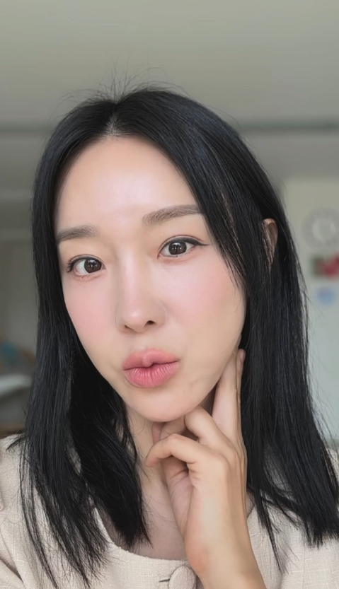 이지혜 인중축소술·실리프팅 전후 비주얼에 반응 폭발