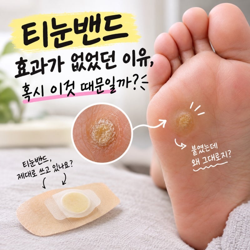 티눈밴드 효과가 없었던 이유, 혹시 이것 때문일까?